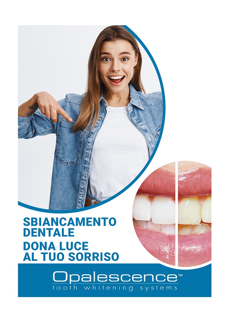 Sbiancamento dentale